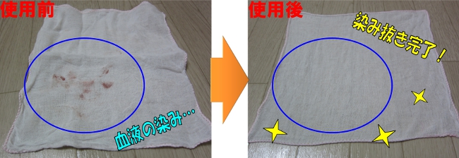 ガーゼについた血液の染みが簡単に漂白できます